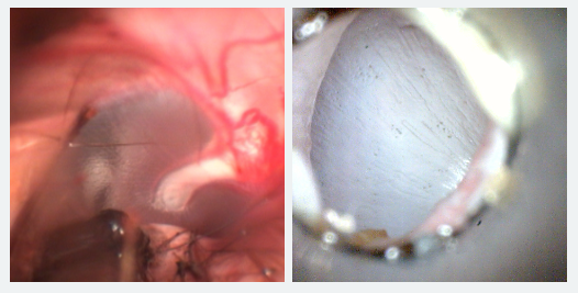 Video Otoscopy - Normal Ear Drum of dog (left) and of cat (right)