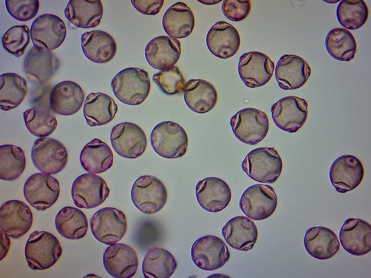 Birch Pollen Under the Microscope