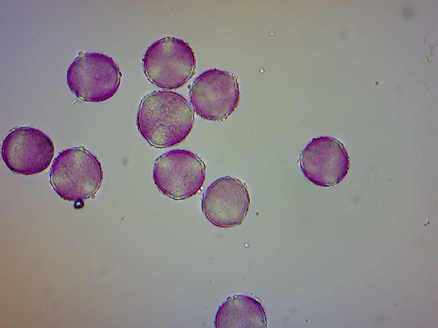 Maple / Box Elder Pollen Under the Microscope